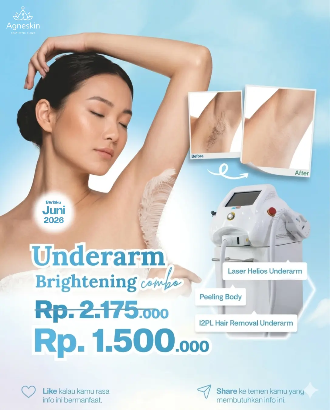 Promo Underarm Brightening Juni 2026